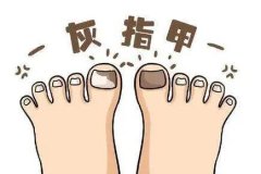 ݻָ׵